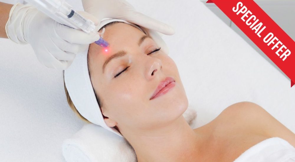 Microneedling & Facecheck